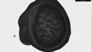 WebGL Volume MRI