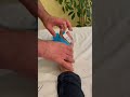 Bunion taping || #shortvideo #viral #fitness #physiotherapy #treatment #taping #tapping