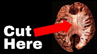 The Unsettling Truth about Human Consciousness | The Split Brain experiment that broke neuroscience