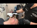 SAY GOODBYE TO ROSACEA WITH THIS LASER | BBL HERO LIGHT THERAPY | Dr. Jason Emer