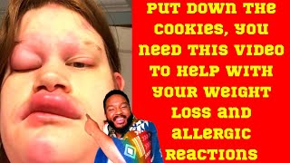 WEIGHT LOSS | ALLERGIC REACTION | NUTRITION | FITNESS | FOOD ALLERGY