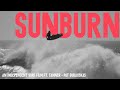 SUNBURN (ft. Tanner + Pat Gudauskas, Yadin Nicol, Bobby Martinez, Chris Ward & friends)