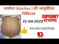 जलोदर Ascites एवं यकृत रोग Liver Disease की आयुर्वेदिक चिकित्सा 21-04 -2023