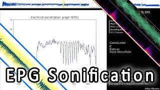 EPG Data Sonification