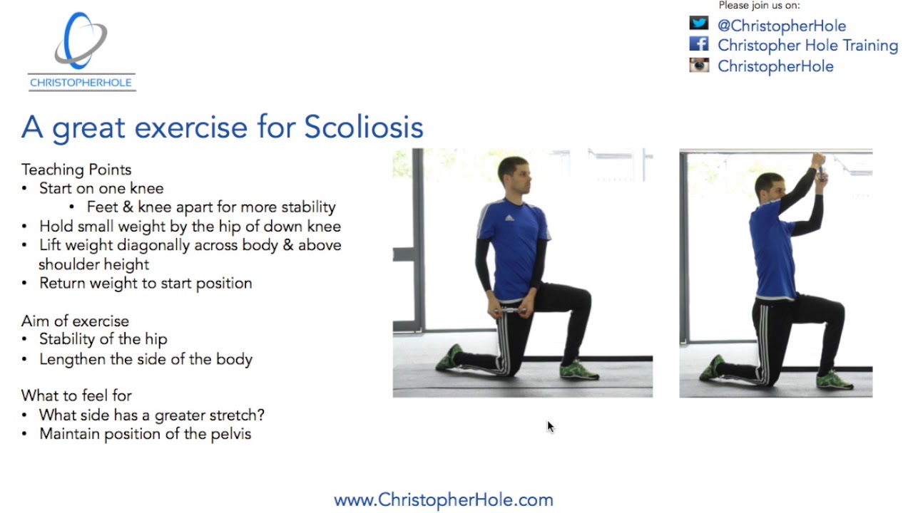 Scoliosis Workout Exercises Eoua Blog