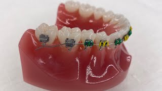 WIRE OUT OF BACK BRACKET At Home Solutions