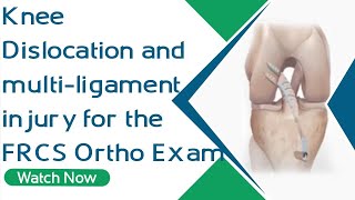 Knee Dislocation and multi-ligament injury for the FRCS Ortho Exam | Orthopaedic Academy