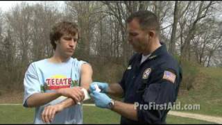 Bleeding Control: Venous Bleeding