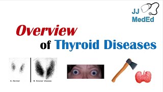 Overview of Thyroid Diseases (Hashimoto’s, Graves’, Sick Euthyroid Syndrome, Toxic adenoma, etc.)