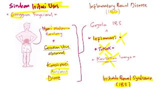 Patofisiologi - Penyakit Sindrom Iritasi Usus (Irritable Bowel Syndrom/ IBS)