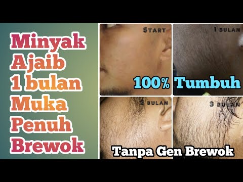 Cara Ampuh Menumbuhkan Brewok Dan Jenggot | 100% Tumbuh - YouTube