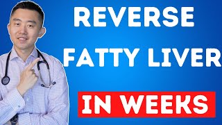 The FASTEST Way to Reverse Fatty Liver, Naturally | NAFLD Treatment