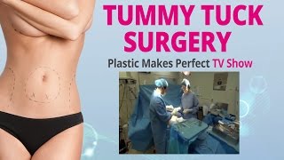 Plastic Makes Perfect TV Show About Tummy Tuck - Edelstein Cosmetic - Toronto