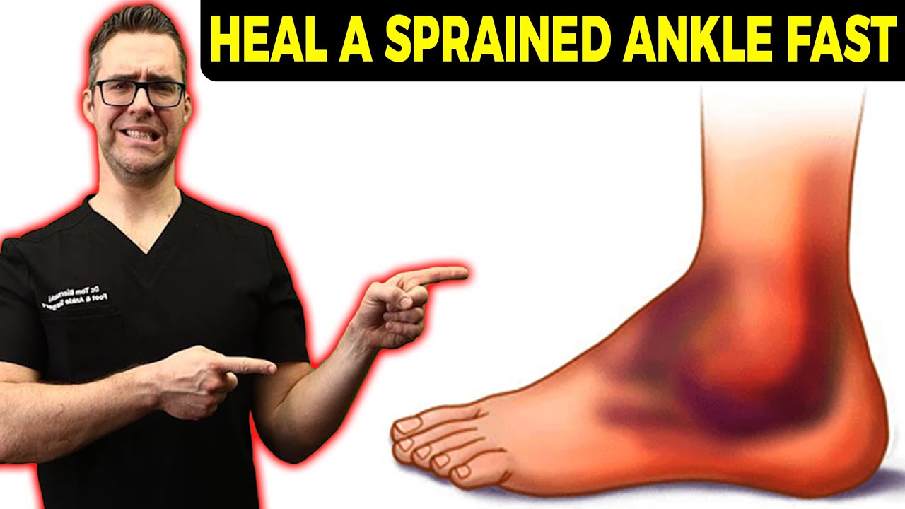 Fix TWISTED Ankle, ROLLED Ankle Or SPRAINED Ankle Ligaments FASTER ...