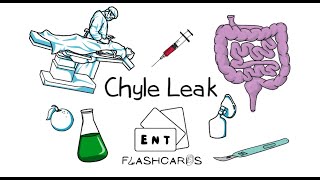 Chyle Leak Frcs Ent Exam Essentials