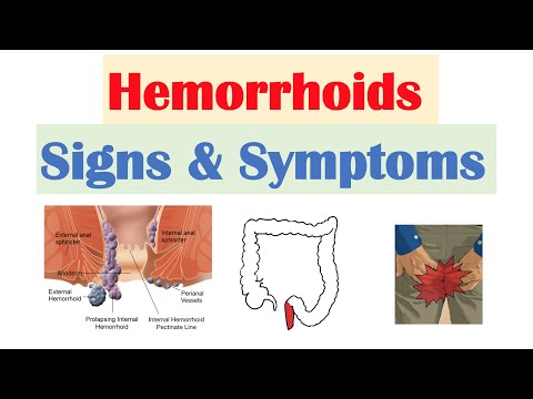 Hemorrhoids - Causes, Types, Stages, Symptoms, Treatment | Diseases 2024