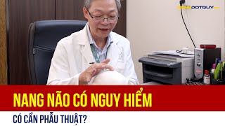 Nang Não Là Gì, Có Nguy Hiểm, Có Cần Phẫu Thuật?