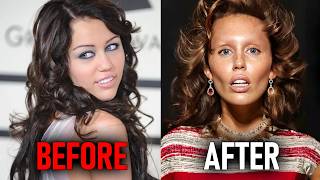 Celebrities Who COMPLETELY RUINED Their Faces With Veneers