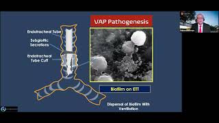 Ventilator Associated Events