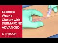 How To Apply DERMABOND ADVANCED Topical Skin Adhesive Effectively | Ethicon