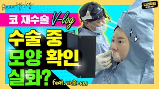 7번째 코 재수술, 주저앉은 코 심페소생술! 제발 이번엔 마지막 수술이 되게 해주세요 ㅠ 코 성형 부작용 재수술 후기 1탄 성형 브이로그