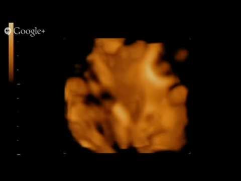 3D Ultrasound and 4D Ultrasounds in Orlando 3D Ultrasound and 4D Ultrasounds in Orlando