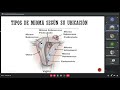 ginecologia miomatosis uterina 2021