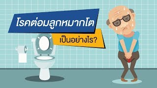 โรคต่อมลูกหมากโตเป็นอย่างไร?