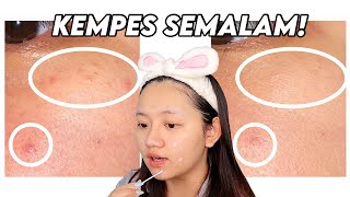 Jerawat Reda Semalam? Review Acne Spot Lokal Baru!