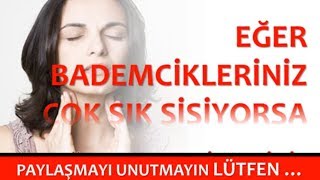 EĞER BADEMCİKLERİNİZ ÇOK SIK ŞİŞİYORSA