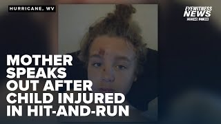 Mother speaks out after child injured in hit-and-run, no arrests made