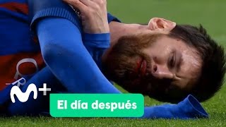 El Día Después (24/04/2017): El Clásico de Messi