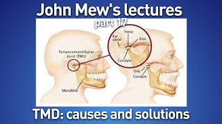John Mew's lectures part 17: TMD causes and solutions