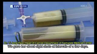 SB anticancer injection is effective on pancreatic cancer (kbs news)