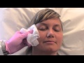 Watch a Botox Treatment at Allure Medical Spa