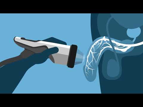 Shockwave Therapy For Erectile Dysfunction - How Does It Work? - YouTube