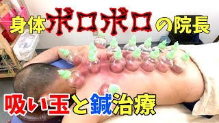 【恵比寿吸い玉鍼】背中が痛いので治療を受けたら院長ボロボロだった【鍼灸院・整体】渋谷区恵比寿コスモ治療院