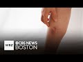 What is cellulitis and how can it be treated?