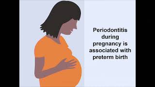 Prevention of Preterm Birth and Neurodevelopmental Delay Using Chewing Gum