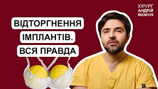 Хвороба відторгнення імплантів: що це за проблема? // @Doctor_Yacobchyk