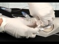 Chapter 8 - PICC Catheter Removal