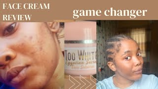 MY HONEST REVIEW ON THIS CREAM | Too white egyptiam face cream |found a facial solution to my face