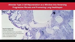 10-10-2024 - Alveolar Type 2 Cell Rejuvenation as a Window into Reversing Progressive Fibrosis ...