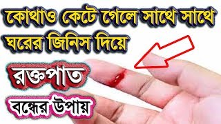 কোথাও কেটে গেলে রক্তপাত বন্ধের ঘরোয়া উপায় - জেনে রাখা ভালো