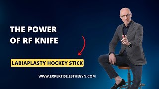 The Power of RF Knife - labiaplasty hockey stick (dr n. med. Piotr Kolczewski)