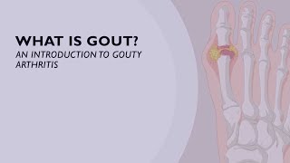 What is Gout? An Introduction to Gouty Arthritis (1 of 6)