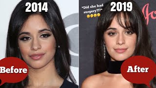 Camila Cabello Had Plastic Surgery