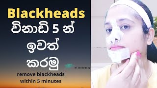 How to remove blackheads  whiteheads  at home | Sinhala | විනාඩි 5 බ්ලැක්/වයිට්හෙඩ්ස් නැති කරමු