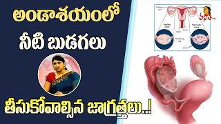 అండాశయంలో నీటి బుడగలు..! | Polycystic Ovary Syndrome (PCOS) Causes | Vanitha TV