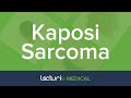 Kaposi's Sarcoma | Lecturio Dermatology